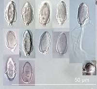 Hysterangium rupticutis image