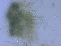 Phaeophleospora atkinsonii image