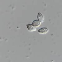 Hirsutella saussurei image