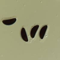 Entalbostroma erumpens image