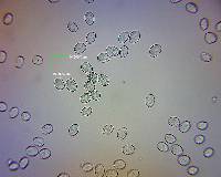 Melanoleuca fusca image
