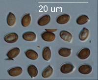 Agaricus karstomyces image