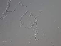 Lecanicillium lecanii image