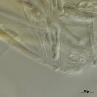 Helotium tasmanicum image