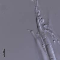 Helotium pateriforme image