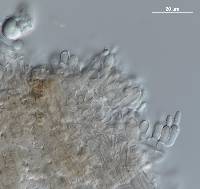 Akanthomyces aranearum image