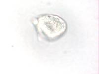 Aecidium ranunculi-insignis image