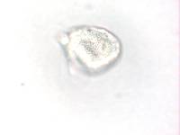 Aecidium ranunculi-insignis image
