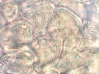 Aecidium ranunculi-monroi image