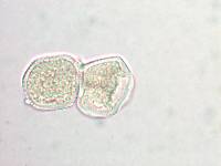 Aecidium ranunculi-monroi image