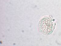 Aecidium ranunculi-monroi image