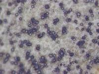 Asteromella myriadea image