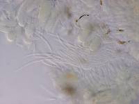 Mycosphaerella rubi image