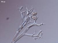 Peronospora viciae image