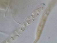 Chlorociboria poutoensis image