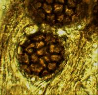 Sphaerosoma trispora image