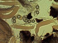 Sphaerosoma trispora image