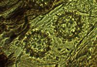 Sphaerosoma trispora image