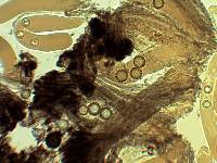 Sphaerosoma trispora image