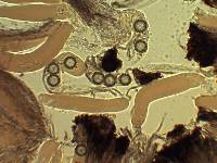 Sphaerosoma trispora image