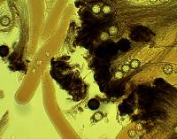 Sphaerosoma trispora image