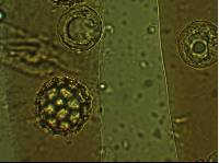 Sphaerosoma trispora image
