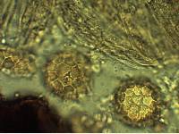 Sphaerosoma trispora image