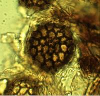 Sphaerosoma trispora image