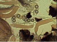 Sphaerosoma trispora image