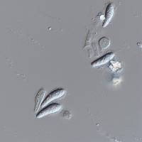 Image of Tiarosporella paludosa