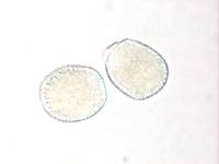 Aecidium ranunculi-insignis image