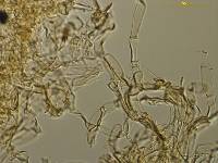 Descomyces albus image