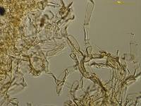 Descomyces albus image