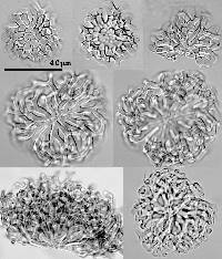 Pseudoclathrosphaerina spiralis image