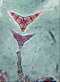 Diplocladiella scalaroides image