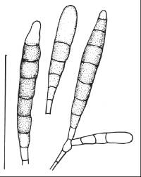 Xylomyces aquaticus image