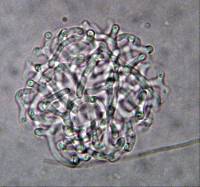 Pseudoclathrosphaerina spiralis image