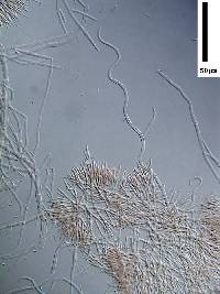 Image of Sarcopodium tortuosum
