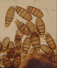 Bactrodesmium nothofagi image