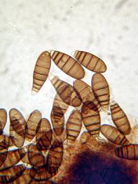Bactrodesmium nothofagi image