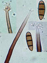 Pleurothecium leptospermi image