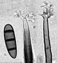 Pleurothecium leptospermi image