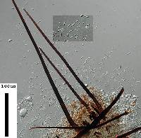 Phomatospora dinemasporium image