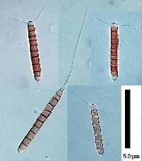 Camposporium antennatum image