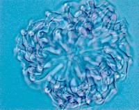 Pseudoclathrosphaerina spiralis image
