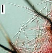 Morrisographium fusisporium image