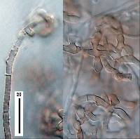 Clathrosporium intricatum image