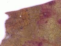 Seimatosporium hypericinum image
