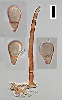 Endophragmiella boewei image