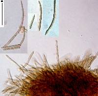 Image of Pseudocercospora ackamae